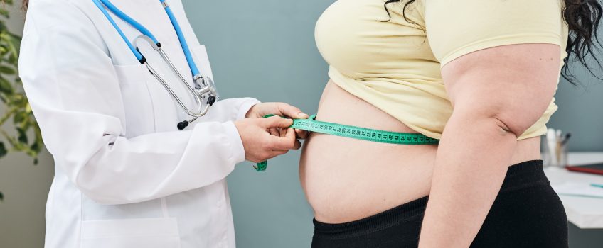 obesity-unhealthy-weight-nutritionist-inspecting-a-womans-waist-using-a-meter-tape-to-prescribe-a-weight-loss-diet